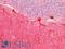 Calbindin 1 antibody, LS-B16861, Lifespan Biosciences, Immunohistochemistry paraffin image 