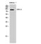 Adhesion G Protein-Coupled Receptor F4 antibody, GTX33971, GeneTex, Western Blot image 