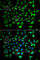 Mitochondrial carnitine/acylcarnitine carrier protein antibody, A6880, ABclonal Technology, Immunofluorescence image 