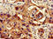Protein Phosphatase 1 Catalytic Subunit Beta antibody, LS-C679122, Lifespan Biosciences, Immunohistochemistry paraffin image 