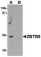 Zinc Finger And BTB Domain Containing 9 antibody, A12548, Boster Biological Technology, Western Blot image 