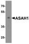 N-Acylsphingosine Amidohydrolase 1 antibody, A02055, Boster Biological Technology, Western Blot image 