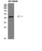 Corticotropin Releasing Hormone Receptor 2 antibody, STJ98962, St John