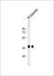 Stimulated by retinoic acid gene 8 protein antibody, MA5-24722, Invitrogen Antibodies, Western Blot image 