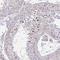 Chromosome 19 Open Reading Frame 54 antibody, NBP2-32485, Novus Biologicals, Immunohistochemistry paraffin image 