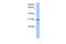 HUS1 Checkpoint Clamp Component B antibody, GTX45681, GeneTex, Western Blot image 