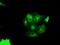 Pim-2 Proto-Oncogene, Serine/Threonine Kinase antibody, NBP2-02441, Novus Biologicals, Immunofluorescence image 