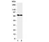Potassium Voltage-Gated Channel Subfamily A Member 6 antibody, R31395, NSJ Bioreagents, Western Blot image 