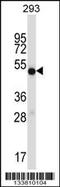 Inosine Monophosphate Dehydrogenase 1 antibody, 57-112, ProSci, Western Blot image 