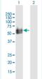 Hyaluronidase 2 antibody, H00008692-B02P-50ug, Novus Biologicals, Western Blot image 