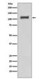 Death Domain Associated Protein antibody, M00439, Boster Biological Technology, Western Blot image 