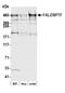 Bromodomain PHD Finger Transcription Factor antibody, A300-973A, Bethyl Labs, Western Blot image 
