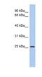 Putative zinc finger protein 833 antibody, NBP1-79360, Novus Biologicals, Western Blot image 