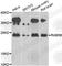 RAB5B, Member RAS Oncogene Family antibody, A7447, ABclonal Technology, Western Blot image 