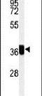 Coiled-Coil Domain Containing 42 antibody, PA5-24940, Invitrogen Antibodies, Western Blot image 