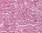 GATA Zinc Finger Domain Containing 2A antibody, NB100-56643, Novus Biologicals, Immunohistochemistry paraffin image 