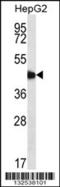 Adipocyte Plasma Membrane Associated Protein antibody, LS-C168069, Lifespan Biosciences, Western Blot image 