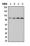 Inhibitor Of Nuclear Factor Kappa B Kinase Subunit Beta antibody, orb393326, Biorbyt, Western Blot image 