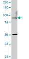 Transient Receptor Potential Cation Channel Subfamily V Member 5 antibody, LS-C139065, Lifespan Biosciences, Western Blot image 