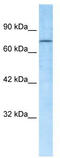 RB Associated KRAB Zinc Finger antibody, TA331800, Origene, Western Blot image 