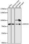 Zinc Finger Protein 333 antibody, LS-C748869, Lifespan Biosciences, Western Blot image 