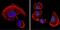 Vitamin D Receptor antibody, MA1-710, Invitrogen Antibodies, Immunofluorescence image 