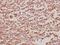 Branched Chain Keto Acid Dehydrogenase Kinase antibody, A07798-1, Boster Biological Technology, Immunohistochemistry frozen image 