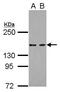 Lysine Demethylase 6A antibody, PA5-31772, Invitrogen Antibodies, Western Blot image 