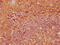 Ectonucleoside Triphosphate Diphosphohydrolase 1 antibody, CSB-PA007690LA01HU, Cusabio, Immunohistochemistry paraffin image 