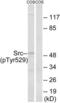 SRC Proto-Oncogene, Non-Receptor Tyrosine Kinase antibody, LS-C117478, Lifespan Biosciences, Western Blot image 