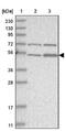 ZFP69 Zinc Finger Protein antibody, NBP1-82215, Novus Biologicals, Western Blot image 