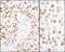 Minichromosome Maintenance Complex Component 2 antibody, NB100-639, Novus Biologicals, Immunohistochemistry paraffin image 