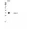 Glucose-dependent insulinotropic receptor antibody, LS-C383756, Lifespan Biosciences, Western Blot image 