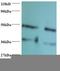 Fatty Acid Binding Protein 3 antibody, LS-C211692, Lifespan Biosciences, Western Blot image 