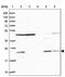 Mitochondrial Ribosomal Protein L17 antibody, PA5-62213, Invitrogen Antibodies, Western Blot image 