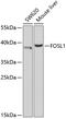FOS Like 1, AP-1 Transcription Factor Subunit antibody, 19-622, ProSci, Western Blot image 
