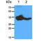 Glycine N-Methyltransferase antibody, GTX57629, GeneTex, Western Blot image 