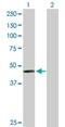 Phenylalanine Hydroxylase antibody, H00005053-D01P, Novus Biologicals, Western Blot image 