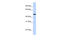 Erythropoietin Receptor antibody, 25-938, ProSci, Western Blot image 