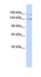 Bromodomain Adjacent To Zinc Finger Domain 1B antibody, orb330066, Biorbyt, Western Blot image 