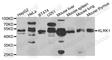 Killer Cell Lectin Like Receptor K1 antibody, A6123, ABclonal Technology, Western Blot image 