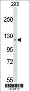 Cilia And Flagella Associated Protein 58 antibody, 59-805, ProSci, Western Blot image 