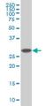 Proteasome 26S Subunit, Non-ATPase 9 antibody, H00005715-M01, Novus Biologicals, Western Blot image 