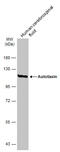 Ectonucleotide pyrophosphatase/phosphodiesterase family member 2 antibody, GTX106209, GeneTex, Western Blot image 