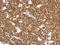 Lymphocyte Cytosolic Protein 1 antibody, NBP2-19860, Novus Biologicals, Immunohistochemistry frozen image 