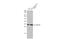 C-X-C Motif Chemokine Ligand 16 antibody, GTX632502, GeneTex, Western Blot image 