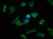 Sorting Nexin 5 antibody, CSB-PA872015LA01HU, Cusabio, Immunofluorescence image 