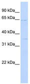 RAR Related Orphan Receptor A antibody, TA337924, Origene, Western Blot image 