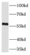 THUMP Domain Containing 3 antibody, FNab08680, FineTest, Western Blot image 