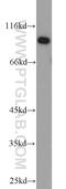 Ubiquitin Protein Ligase E3A antibody, 10344-1-AP, Proteintech Group, Western Blot image 